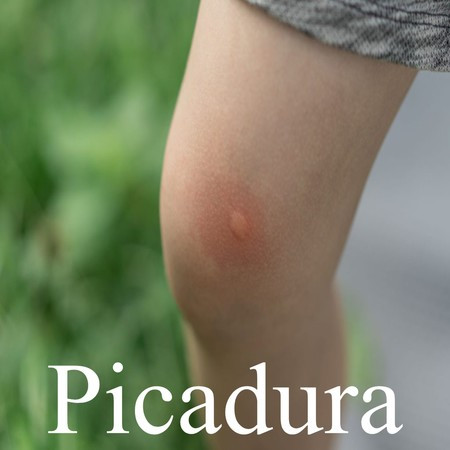 Picadura