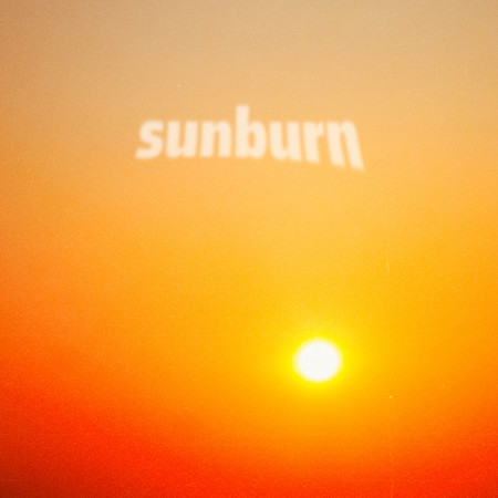 Sunburn