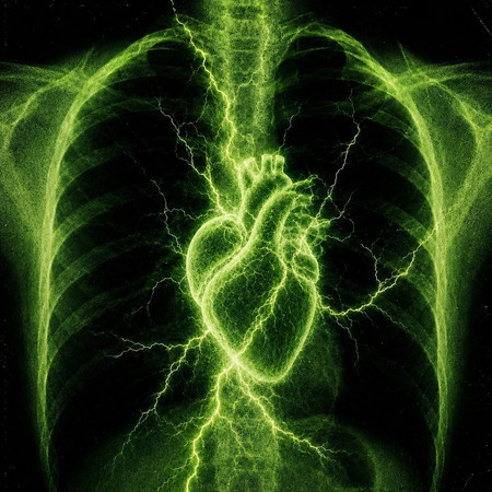 Electric
